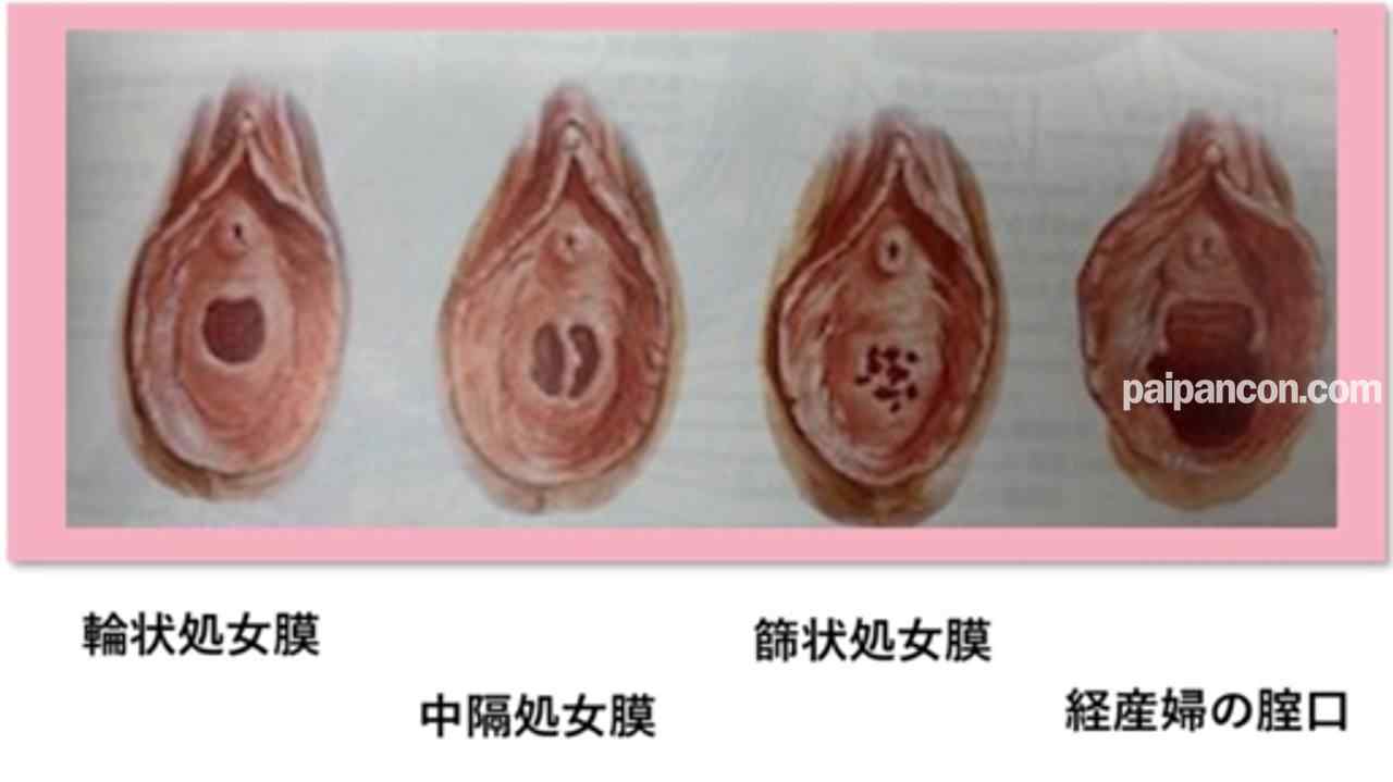 FC2-PPV-2880061 - 純白、『**』『ファーストキス』、、正真正銘の本物の****の瞬間！卒業式から１５日後、１８才！あの偏差値７５の国立の超名門大学合格天才、個撮２３２人目