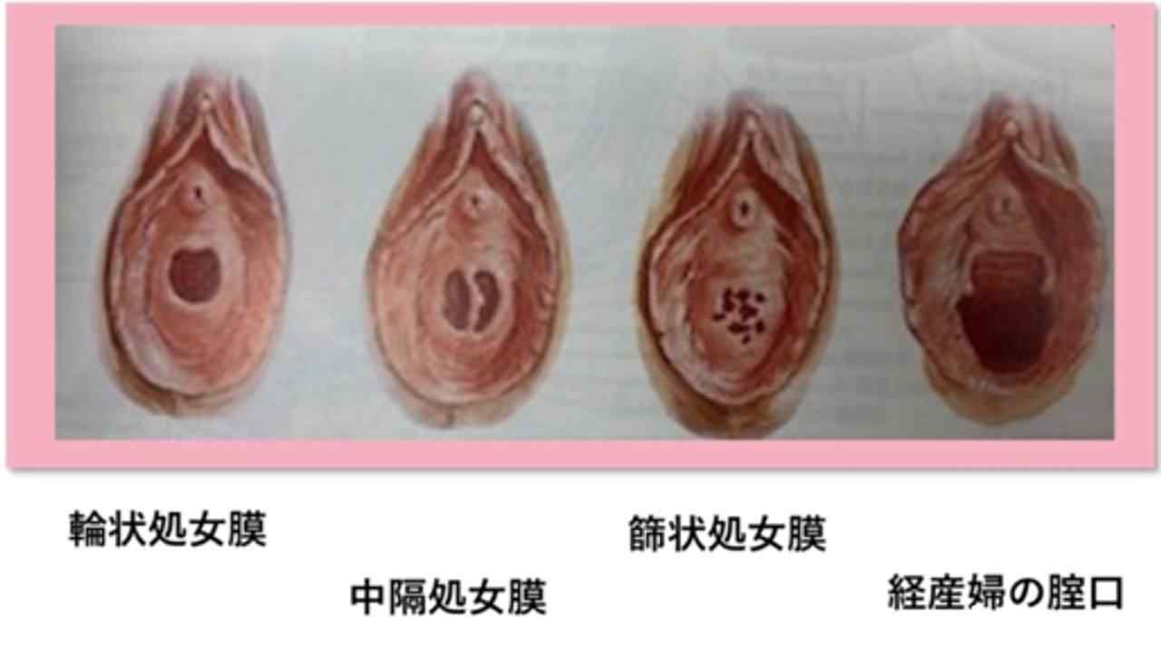 FC2-PPV-3514519 - 独占販売『処女喪失』、正真正銘の本物の処女喪失！！１８才、３ヶ月前まで高*●*生！！学費の支払いに困って、地方からわざわざ撮影に来ました！！処女喪失で人生初めての中出し、完全初撮影！！『個人撮影』個撮オリジナ